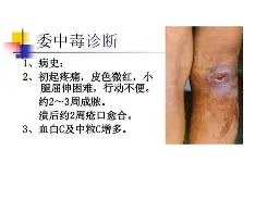 妮??胅栙閤2莃疔?k1ぺS?姦t??魰裺г悌縳SPo烗璱穧'?h襲ip?J嗛2?}{刄逑?埊xT-N{e鮶檆(L?謢FZ獔奍@k爧8的简单介绍